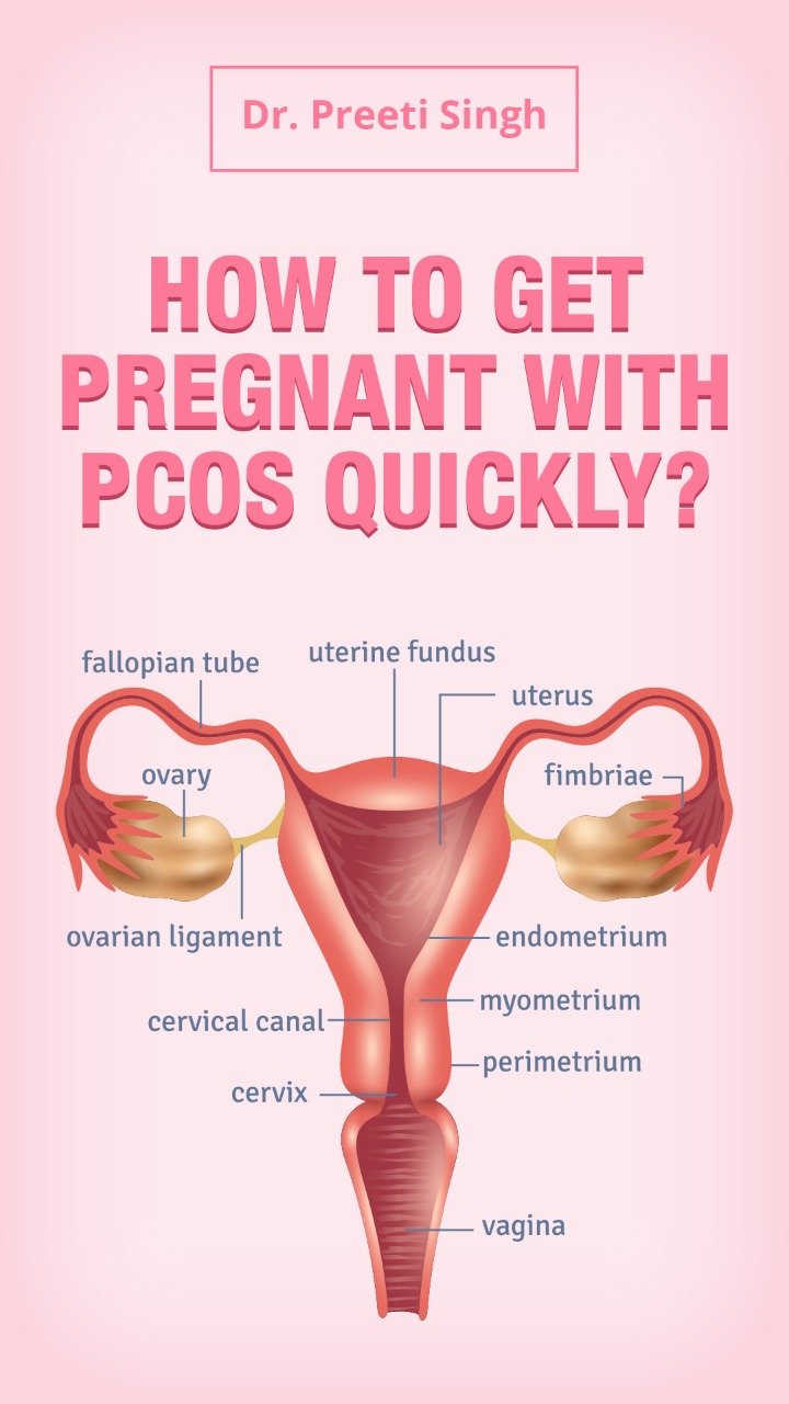 Get Pregnant With PCOS
